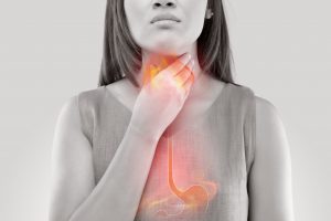 Heartburn and Acid Reflux and GERD…Oh my! Symptoms, Diagnosing and Treatment