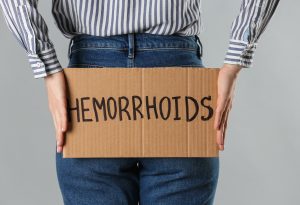 Everything You Need to Know About Hemorrhoids